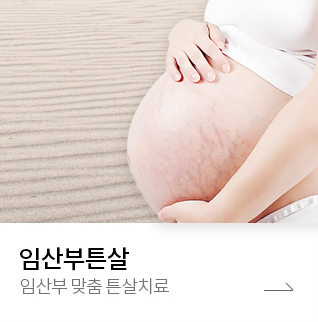 임산부튼살